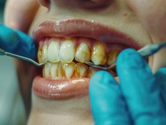 Dentiste examinant la coloration des dents d’une patiente lors d’un contrôle bucco-dentaire.