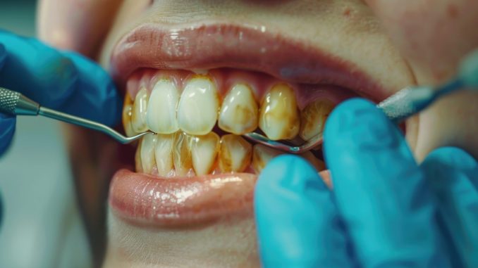 Dentiste examinant la coloration des dents d’une patiente lors d’un contrôle bucco-dentaire.